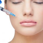 Dermal Fillers