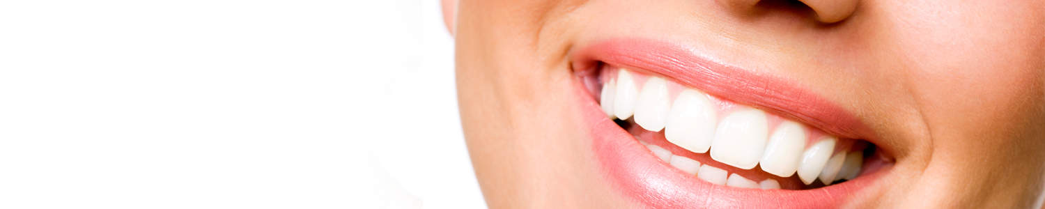 teeth-whitening